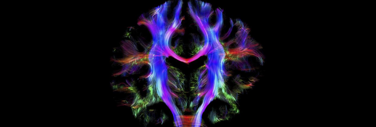 From stimulation of neurons by light to artificial intelligence to analyze MRI scans